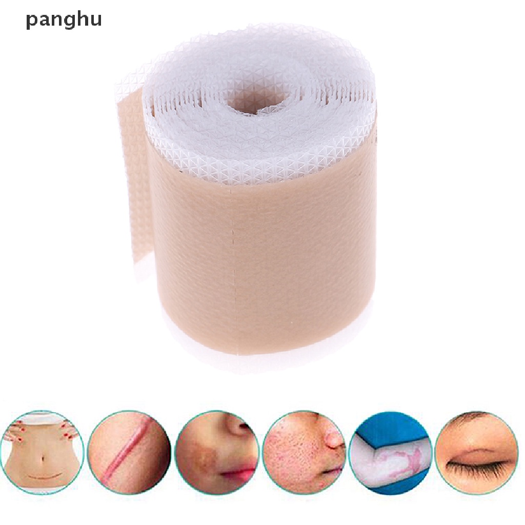 [Hàng mới về] Cuộn miếng dán gel silicone xóa giảm vết sẹo 4x150cm