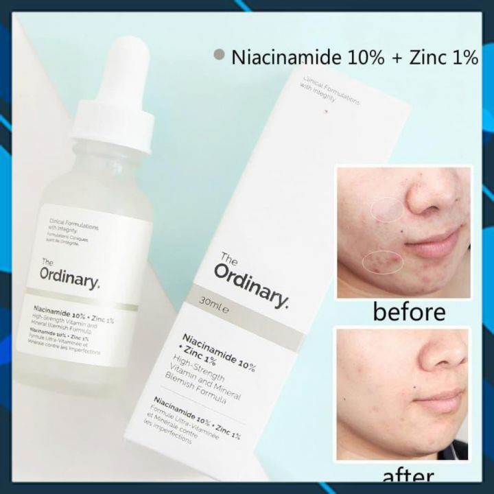 [COMBO] Serum The Ordinary Niacinamide 10% 30ml + Hyaluronic Acid 2% + B5 30ml - Whie Store | BigBuy360 - bigbuy360.vn