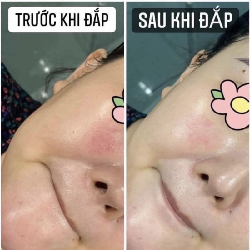 Mặt nạ phục hồi da SMAS Peptide Silk Mask