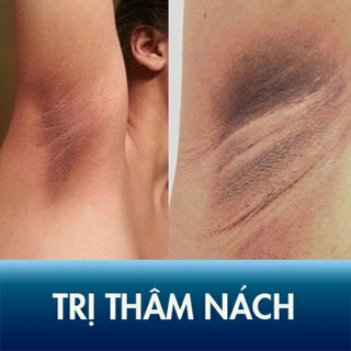 Kem Trắng Da Nách Hết Thâm Mịn Màng