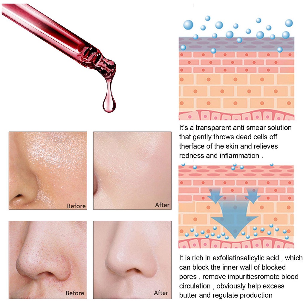 Serum Salicylic Acid Dưỡng Ẩm Thu Nhỏ Lỗ Chân Lông