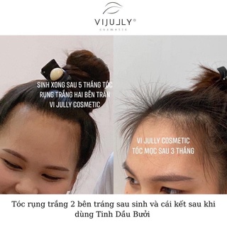 Dầu gội vijully-chính hãng