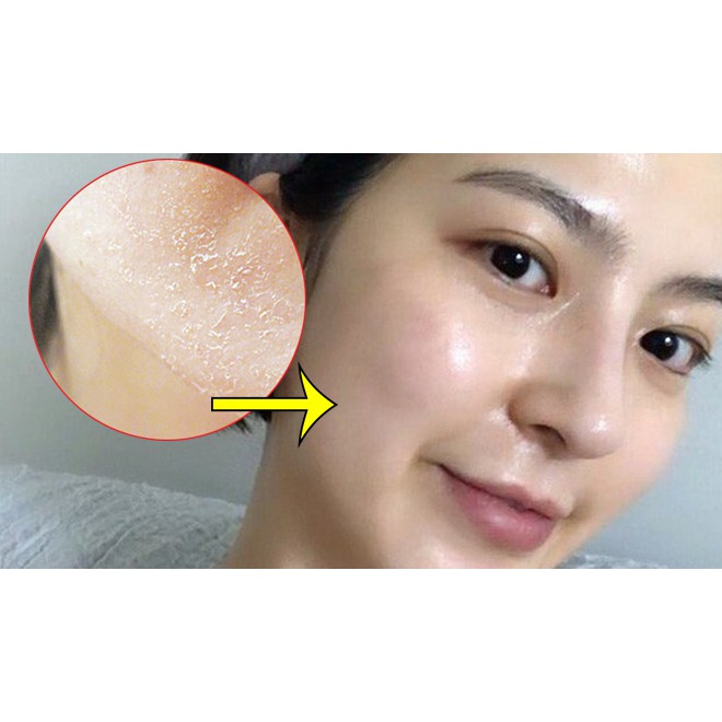 Sữa dưỡng thể La Roche-Posay dành riêng cho da khô và nhạy cảm