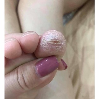 Kem Đông Y Á Sừng