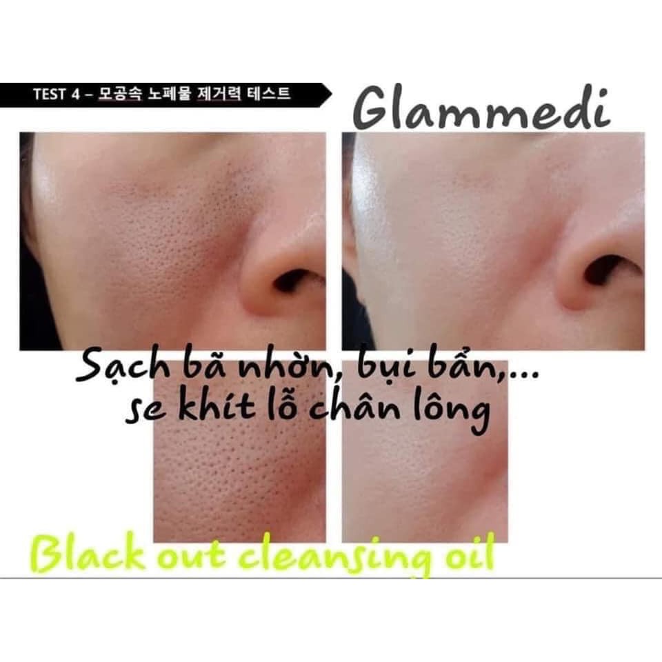 Dầu tẩy trang KÍCH Ủ MỤN ĐẦU ĐEN 3 in1 Glammedi Black Out Cleansing Oil