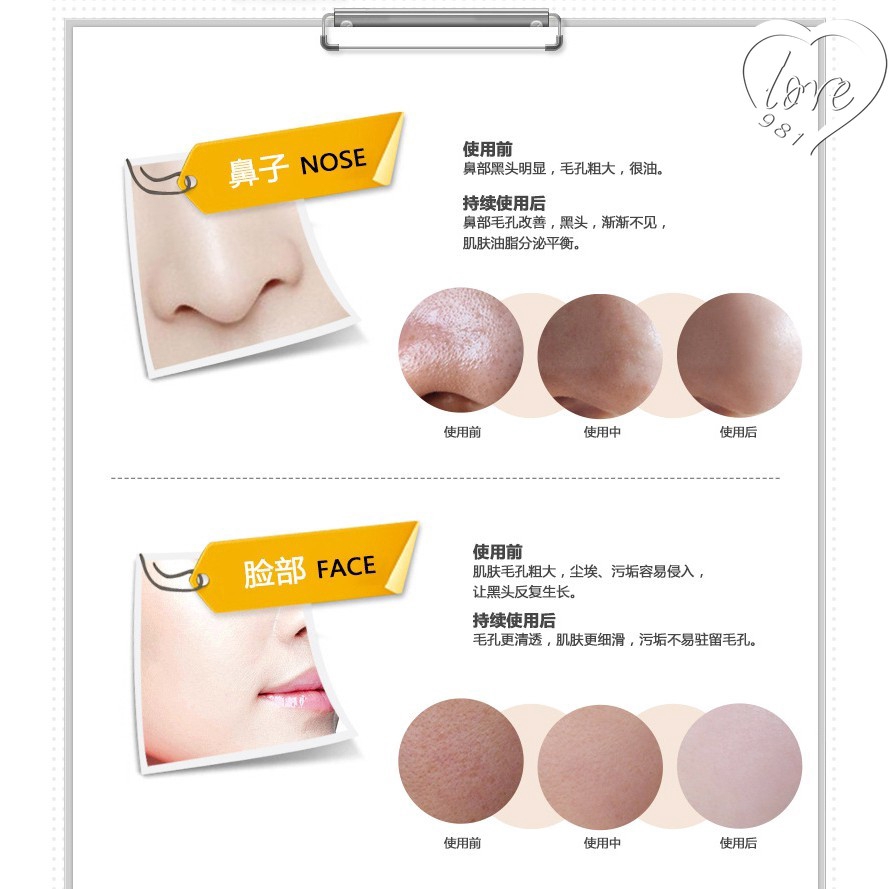 Mặt nạ lột mụn đầu đen làm sạch sâu lỗ chân lông | BigBuy360 - bigbuy360.vn