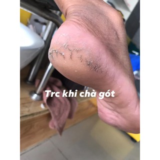 Dụng cụ chà/mài gót chân 4 in 1
