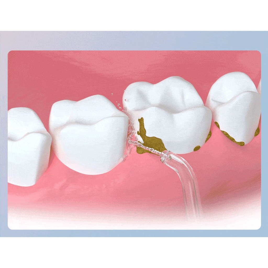 Máy Tăm Nước Xiaomi Enpuly ML8 Vệ Sinh Răng Miệng Dung Tích 250ML Chống Nước IPX7 - BH 12 Tháng