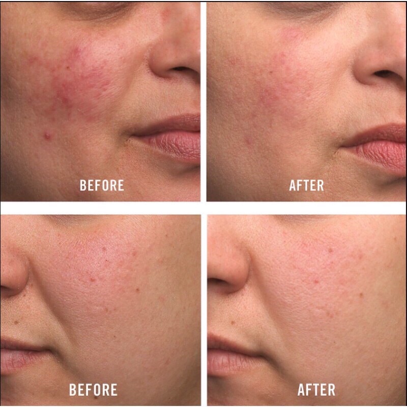 Kem dưỡng ẩm phục hồi da First Aid Beauty Ultra Repair Cream Intense Hydration 226g HSD 2/2024