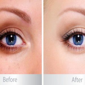 Kem Dưỡng Mắt Nọc Rắn Balance Active Formula Làm Giảm Quầng Thâm, Bọng Mắt 15ml | BigBuy360 - bigbuy360.vn