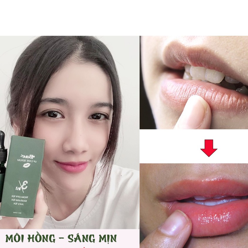 Serum dưỡng Môi Bae - Lip Care Serum