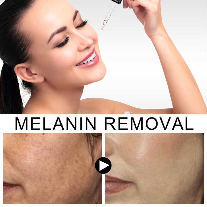 Tinh chất Melanin tự nhiên loại bỏ tàn nhang chống lão hóa dưỡng ẩm | BigBuy360 - bigbuy360.vn