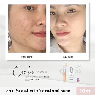 Kem mụn LoriB 10ml
