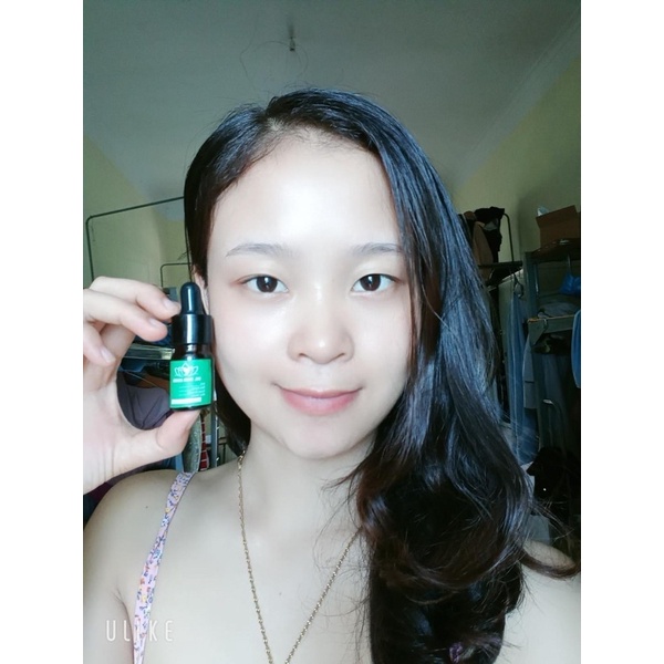 Serum mụn ( dr.skinacnes) | BigBuy360 - bigbuy360.vn