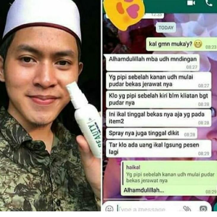 Bình Xịt Làm Đẹp Tự Nhiên 100%EF39 (Trims,.) | BigBuy360 - bigbuy360.vn