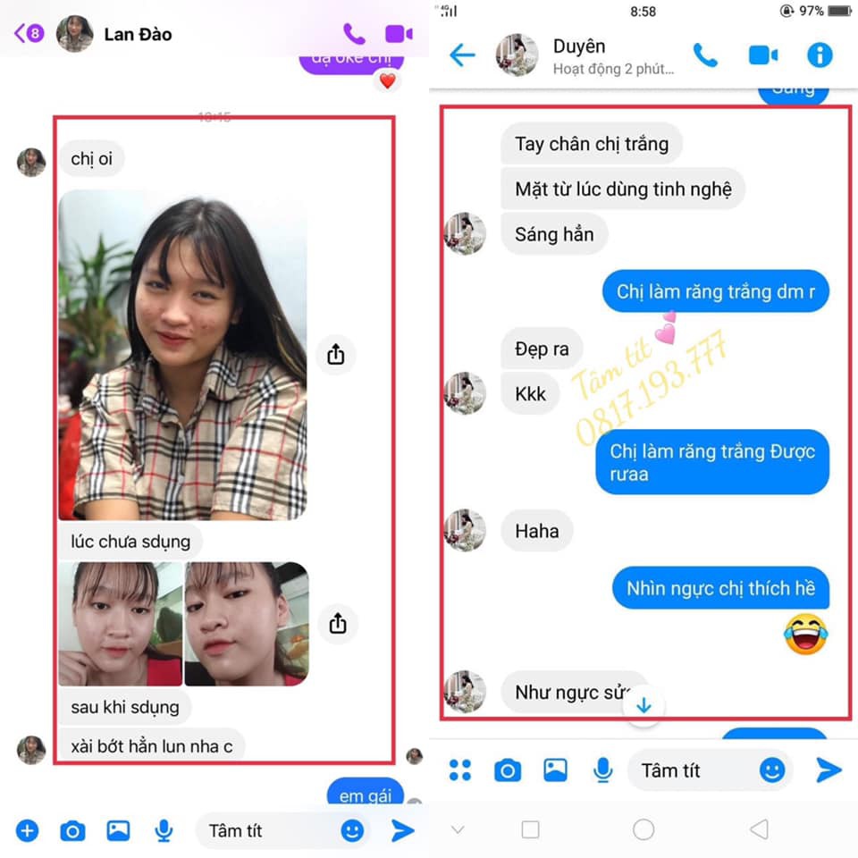 CAO NGHỆ MẶT TRẮNG DA | BigBuy360 - bigbuy360.vn