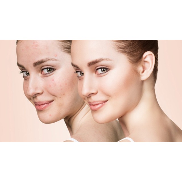 Sữa Rửa Mặt  Trà Xanh Innisfree GREEN TEA  FOAM CLEANSER 150ml) | BigBuy360 - bigbuy360.vn