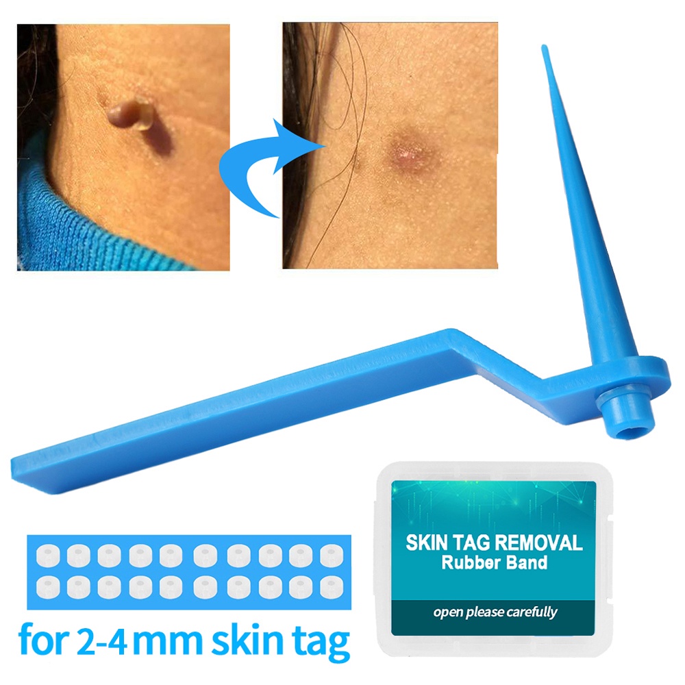 Bộ Dụng Cụ Tẩy Nốt Ruồi Mụn Cóc Chăm Sóc Da Cho Người Lớn