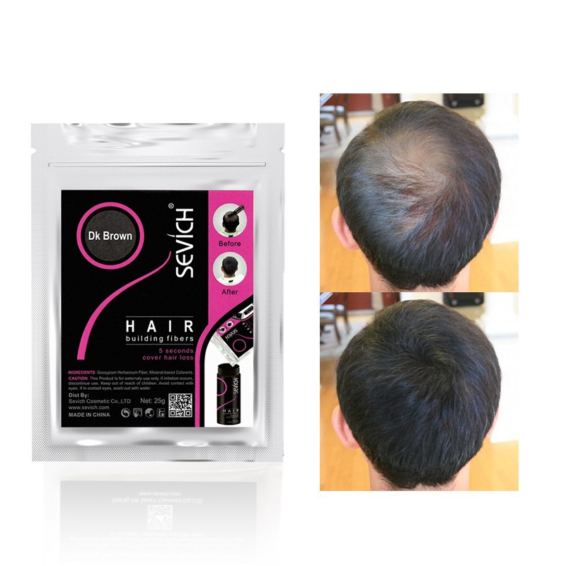 SEVICH làm dày tóc che hói đầu, dày tóc thưa, bột phủ che hói đầu 500g