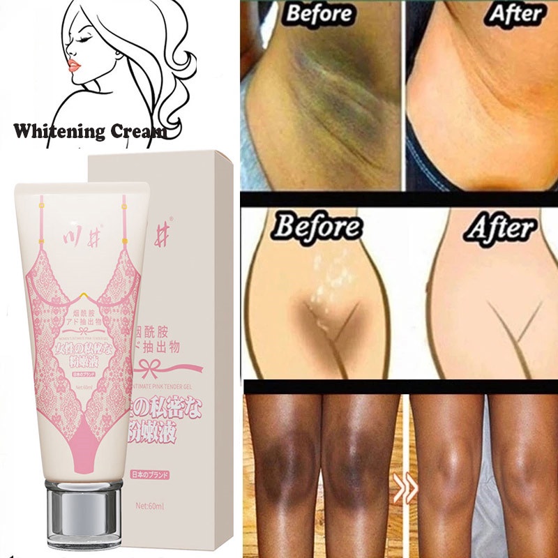 Kem Làm Trắng Da Toàn Thân Dưới Đầu Gối Cải Thiện Sắc Tố melanin