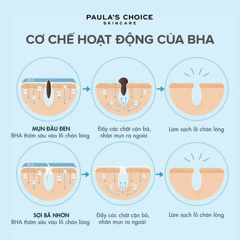 [PAULA'S CHOICE] BHA Dành Cho Da Mụn Vừa Đến Nặng Clear Extra Strength Anti-Redness Exfoliating Solution 118ml (Mã 6210)