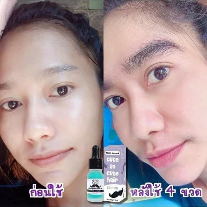 💜Cute so Cute hair 👨serum mọc râu lông may, lông ria , lông  mép ✅.