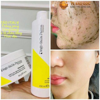 Peel da TẢO Ý tách set liệu trình 5 lần, căng bóng, se lỗ chân lông, trắng sáng