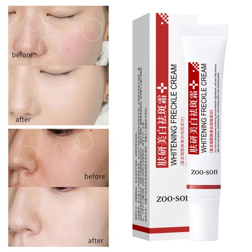 Dark Spot Corrector Cream Whitening Freckle Cream Powerful Removing Melasma Melanin Dark Spots Pigmentation Brightening Moisturizing Skin Care 20g