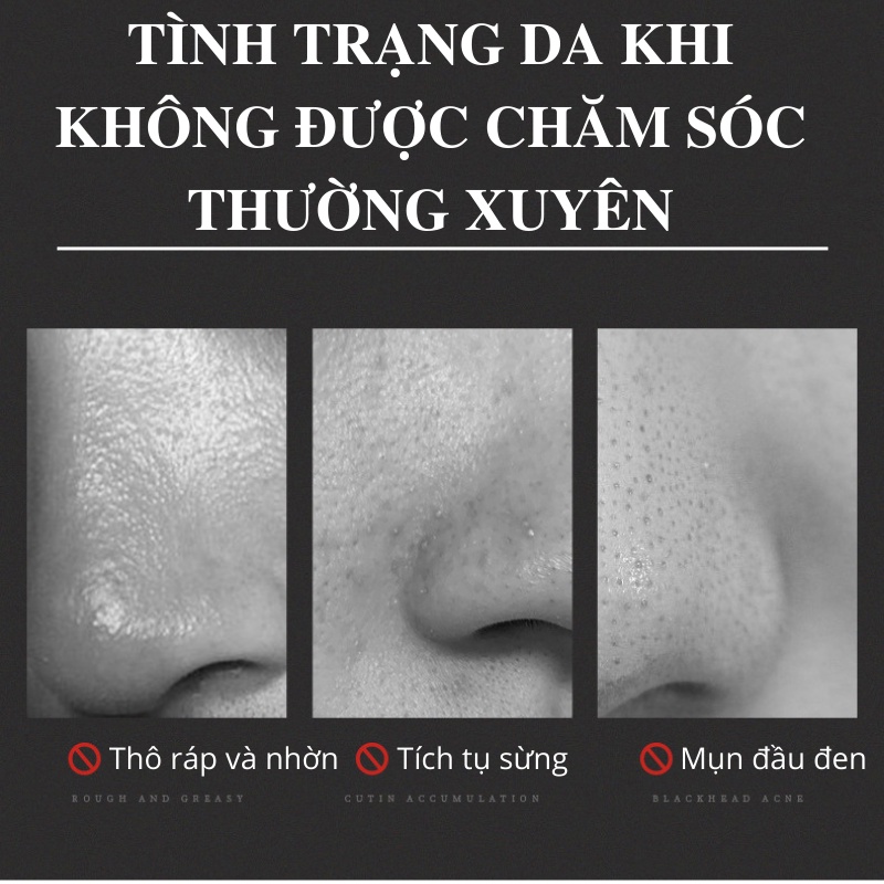 Bộ 3 sản phẩm hút mụn đầu đen và dưỡng da nam Veze