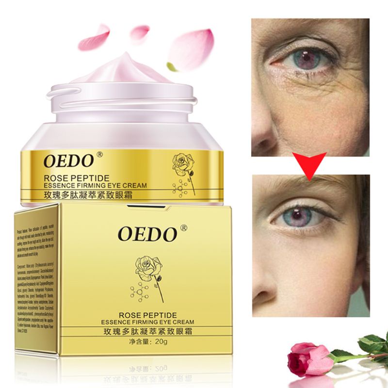 XIXI Kem dưỡng da mắt OEDO 20g chống lão hóa và nếp nhăn
 | BigBuy360 - bigbuy360.vn