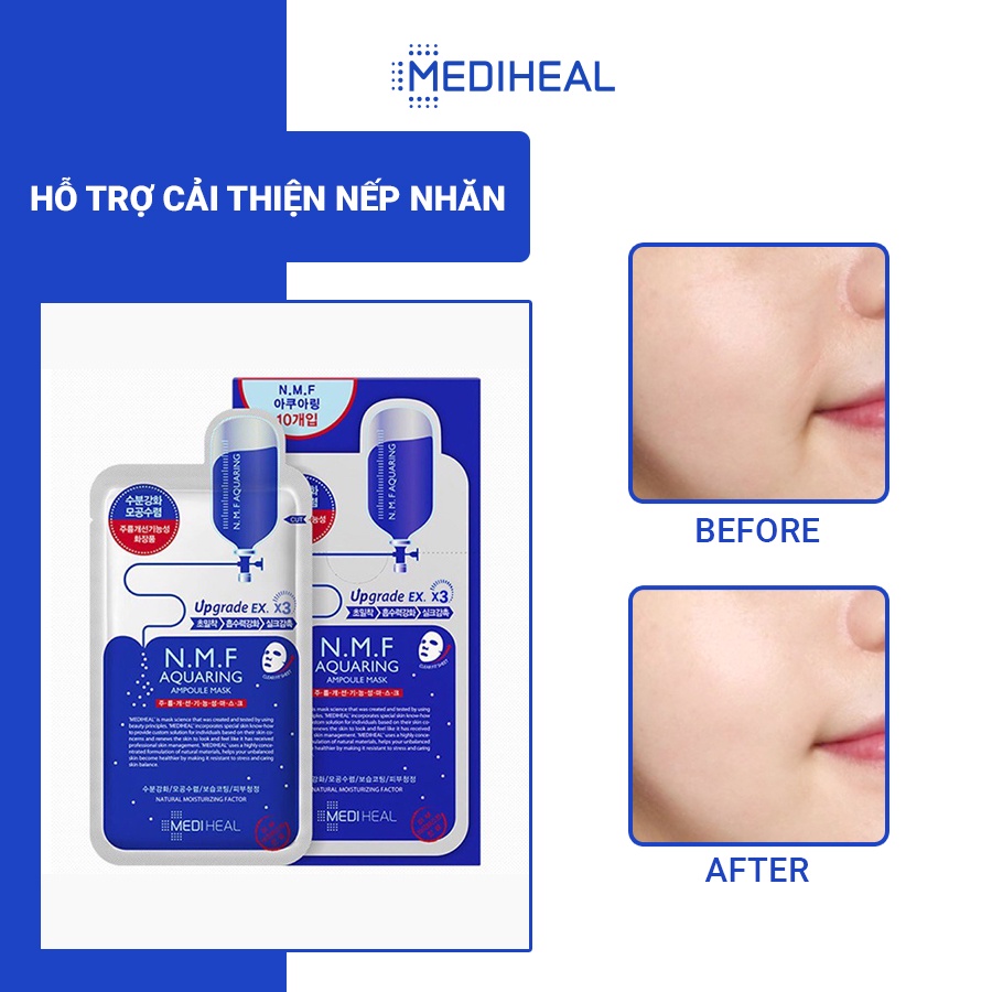 [COMBO 5] Mặt Nạ Cấp Ẩm Cho Da Mediheal N.M.F Aquaring Ampoule Mask Ex 27ml