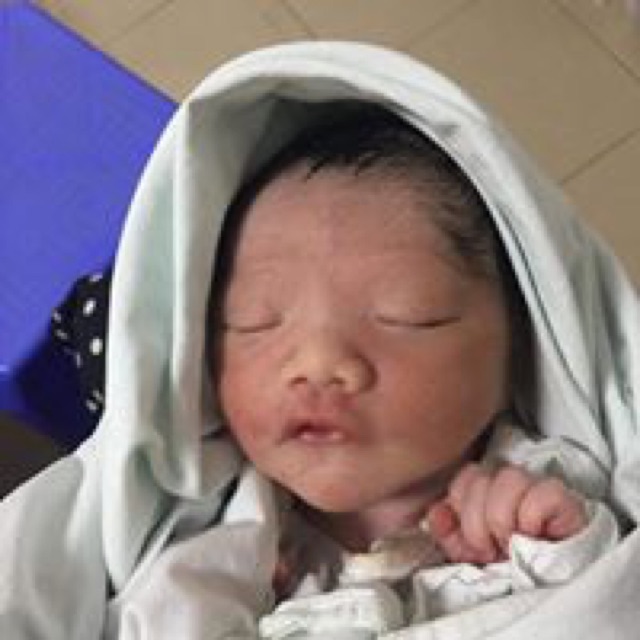 đai nẹp nhập khẩu