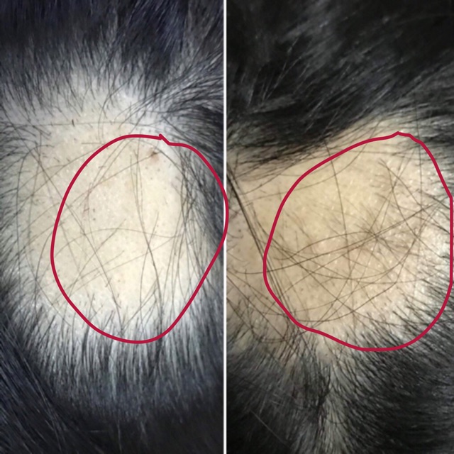 Tinh dầu bưởi kích tóc nhanh mọc | BigBuy360 - bigbuy360.vn