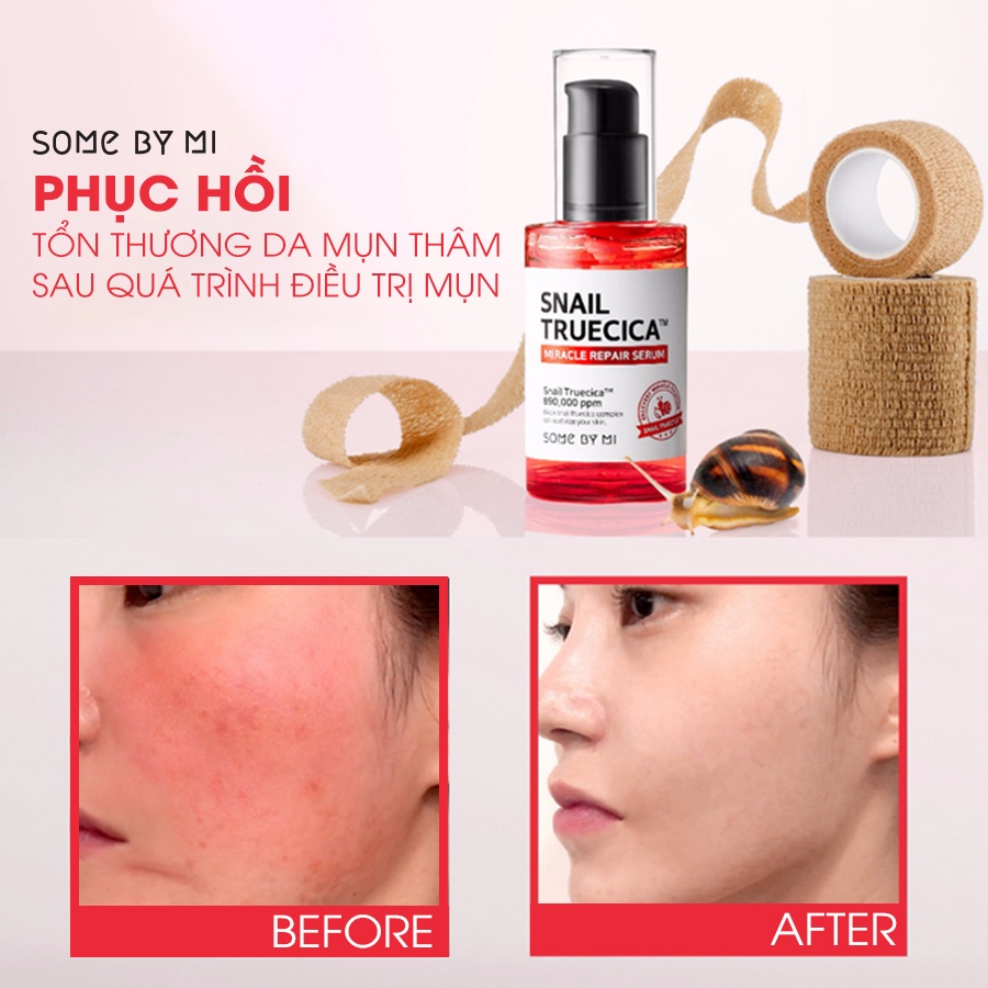 Tinh Chất Snail TrueCica Serum Some By Mi