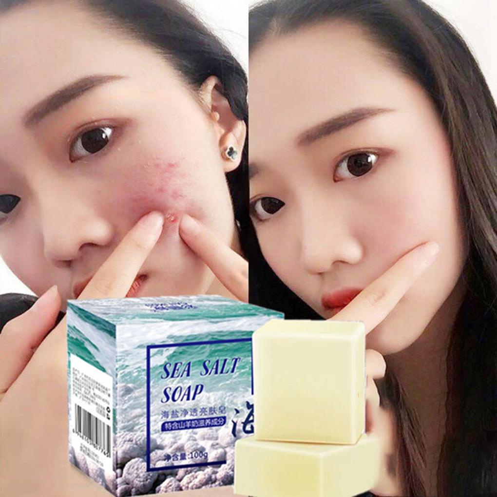 Xà Phòng Sữa Muối Biển Giúp Dưỡng Ẩm Và Trị Mụn Cao Cấp