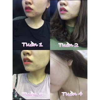 [QUÀ 🎁] Tinh Chất Sâm Đất-Saffron
