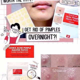Miếng Dán Mụn Cosrx - BONBONCOSMETIC
