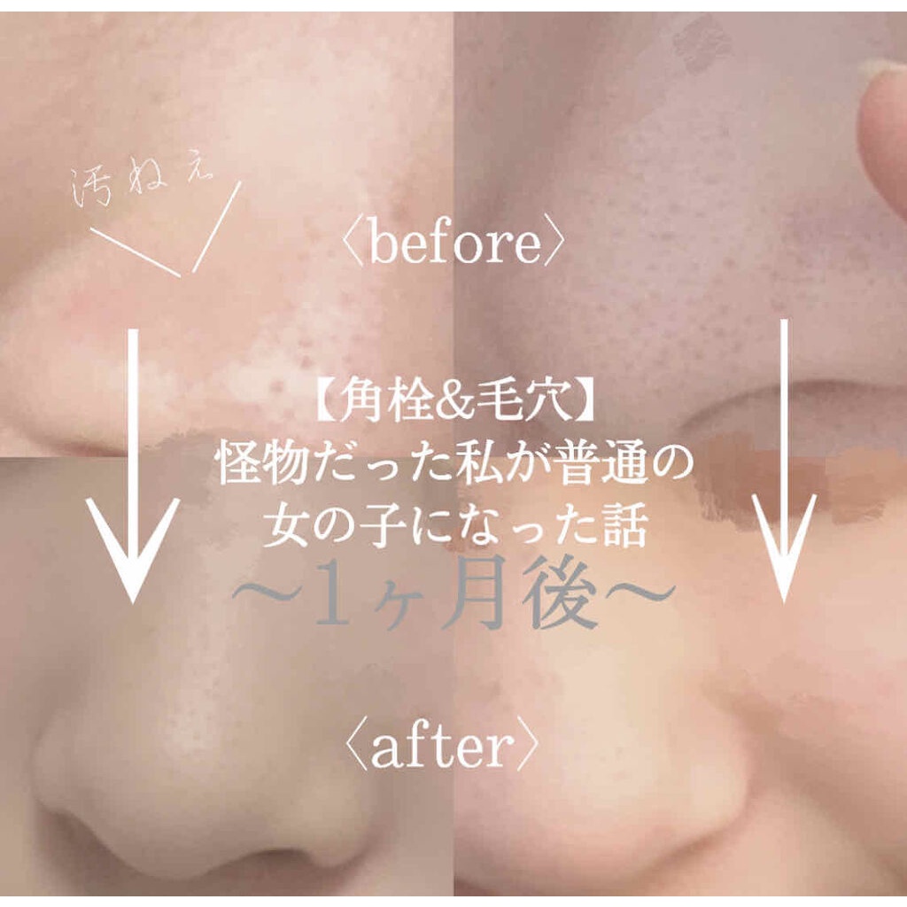 Kem làm giảm mụn đầu đen Keana Nadeshiko Baking Soda Nose Cream Pack - Nhật Bản 15g