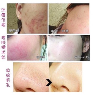 Serum dưỡng da Royal nhật bản
