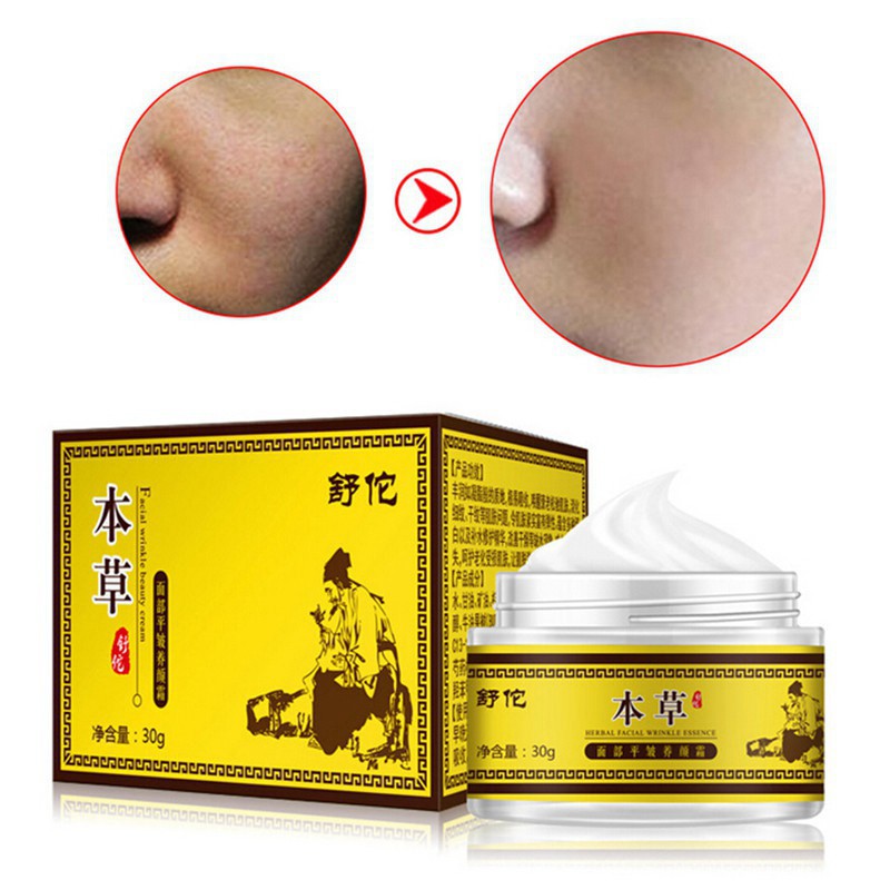 Kem Dưỡng Da Mặt Chứa Vitamin E Giúp Dưỡng Ẩm Và Chống Lão Hóa Hiệu Quả
