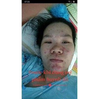 KEM FACE CHUYÊN MỤN HUỲNH ĐỖ