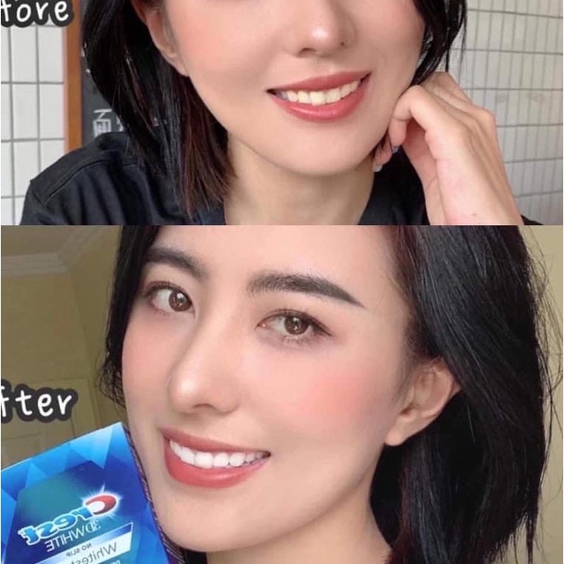 [FREE SHIP] Miếng Dán Trắng Răng 3D Crest Xịn