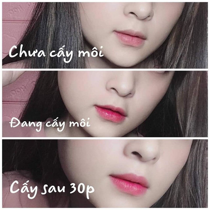 [Chính Hãng]Tinh Chất Cấy Môi Vaura Babier Lips Volume ,mờ thâm làm hồng môi sau 7 ngày