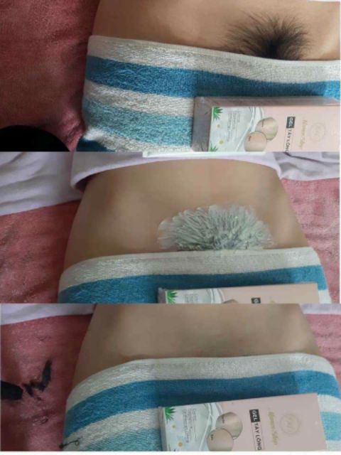 Kem Triệt Râu Lông Vĩnh Viễn Tận Gốc Chính Hãng | BigBuy360 - bigbuy360.vn