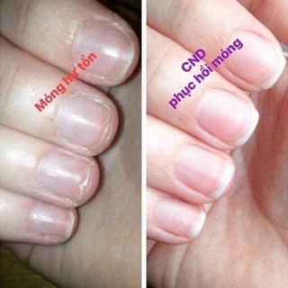 Dưỡng Móng Phục Hồi Móng CND