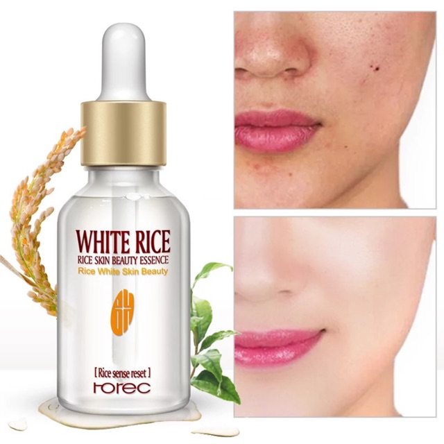 Serum dưỡng trắng da Rice White Skin Beauty Của Rorec Senabeauty | BigBuy360 - bigbuy360.vn