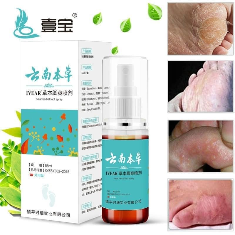 ✔️BÁN BUÔN - Chai xịt khử mùi hôi chân và xịt giày, khô nhanh,khử mùi hôi tức thì [MP086]