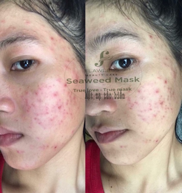 Bán sỉ Mặt nạ tảo biển Hàn Quốc 10 miếng/gói - Seaweed Mask - Hàng chính hãng check code- mẫu mới nhất date 1 năm | Thế Giới Skin Care