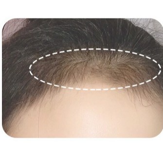 Xixi (Hàng Mới Về) Phấn Che Khuyết Điểm Chân Tóc Tiện Dụng Chất Lượng Cao | BigBuy360 - bigbuy360.vn