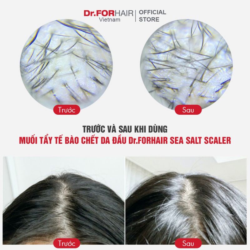 Muối tẩy tế bào chết da đầu Dr.FORHAIR